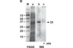 Western Blot analysis of ABIN125786 specificity. (Galectin 2 antibody)