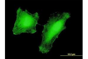 Immunofluorescence of monoclonal antibody to KAT2B on HeLa cell. (KAT2B antibody  (AA 353-452))
