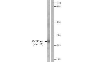 Western blot analysis of extracts from Jurkat cells. (PRKAB1 antibody  (pSer182))