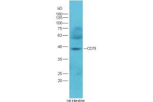 Rat intestine lysates probed with Rabbit Anti-CD75 Polyclonal Antibody  at 1:300 overnight in 4˚C. (ST6GAL1 antibody  (AA 301-406))