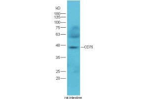 ST6GAL1 anticorps  (AA 301-406)