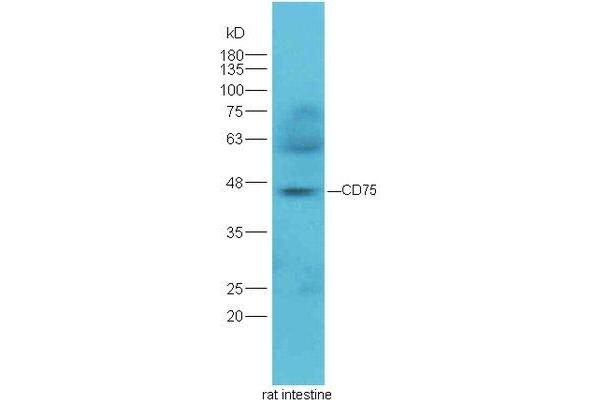 ST6GAL1 antibody  (AA 301-406)
