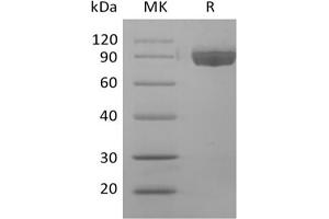 Western Blotting (WB) image for Afamin (AFM) protein (His tag) (ABIN7319846) (Afamin Protein (AFM) (His tag))