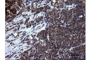 Image no. 5 for anti-RAB37, Member RAS Oncogene Family (RAB37) antibody (ABIN1500561)