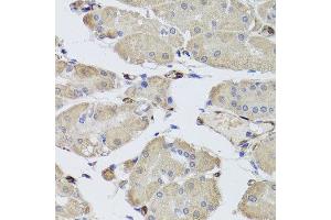 Immunohistochemistry of paraffin-embedded human stomach using FABP5 antibody at dilution of 1:100 (x40 lens). (FABP5 antibody)