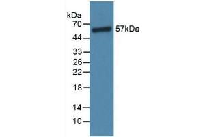 Detection of ANGPT1 in Rat Lung Tissue using Polyclonal Antibody to Angiopoietin 1 (ANGPT1) (Angiopoietin 1 antibody  (AA 304-450))