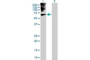 Western Blot analysis of BRF1 expression in transfected 293T cell line by BRF1 MaxPab polyclonal antibody. (BRF1 antibody  (AA 1-473))