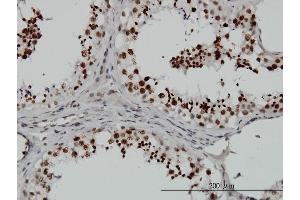 Immunoperoxidase of monoclonal antibody to SMG1 on formalin-fixed paraffin-embedded human testis. (SMG1 antibody  (AA 2922-3031))