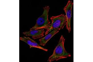 Confocal Immunofluorescent analysis of A2058 cells using AF488-labeled S100B Monoclonal Antibody (4C4.