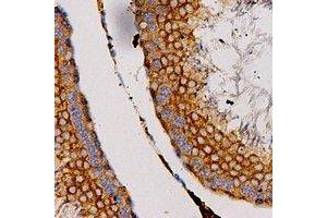 Immunohistochemical analysis of CCL27 staining in human testis formalin fixed paraffin embedded tissue section. (CCL27 antibody)