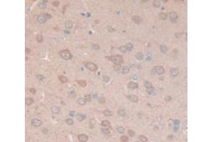IHC-P analysis of Rat Tissue, with DAB staining. (MGP antibody  (AA 1-103))