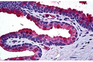 Human Prostate: Formalin-Fixed, Paraffin-Embedded (FFPE) (TIMP2 antibody  (AA 27-221))
