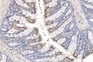 Immunohistochemistry analysis of paraffin-embedded rat rectum using,SYTL2 (ABIN7075797) at dilution of 1: 1600 (SYTL2 antibody)