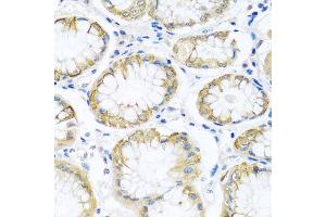 Immunohistochemistry of paraffin-embedded human stomach using PCDHA12 antibody at dilution of 1:100 (x40 lens). (PCDHA12 antibody)