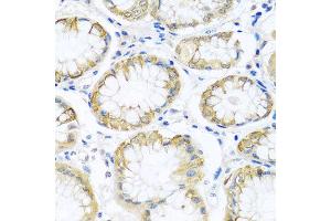 Immunohistochemistry of paraffin-embedded human stomach using PCDHA12 antibody at dilution of 1:100 (x40 lens).