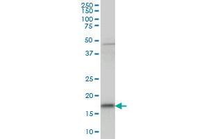 TSEN15 antibody  (AA 72-170)