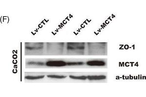 MCT4 destroys epithelial barrier function and inhibits ZO-1 expression.