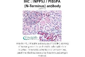 Image no. 1 for anti-Inositol Polyphosphate-5-Phosphatase J (INPP5J) (N-Term) antibody (ABIN1735940)