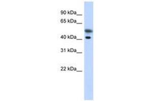 Image no. 1 for anti-Tropomodulin 2 (TMOD2) (N-Term) antibody (ABIN6741280)