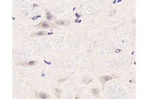 Immunohistochemistry analysis of paraffin-embedded rat brain using CDC25A Polyclonal Antibody at dilution of 1:1000. (CDC25A antibody)