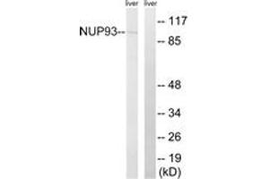 Western blot analysis of extracts from rat liver cells, using NUP93 Antibody. (NUP93 antibody  (AA 221-270))