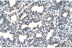 Human Lung (KCTD6 antibody  (N-Term))