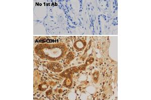 Immunohistochemistry (IHC) image for anti-Cadherin 1, Type 1, E-Cadherin (Epithelial) (CDH1) antibody (ABIN6254215) (E-cadherin antibody)
