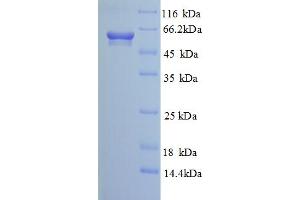 SDS-PAGE (SDS) image for Calcium Activated Nucleotidase 1 (CANT1) (AA 80-397), (partial) protein (GST tag) (ABIN5712838)