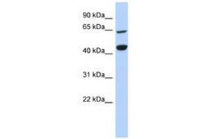 Image no. 1 for anti-Replication Factor C (Activator 1) 4, 37kDa (RFC4) (AA 287-336) antibody (ABIN6740953) (RFC4 antibody  (AA 287-336))