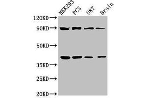 Western Blot Positive WB detected in: HEK293 whole cell lysate, PC-3 whole cell lysate, U87 whole cell lysate, Rat brain tissue All lanes: TRIM54 antibody at 3 μg/mL Secondary Goat polyclonal to rabbit IgG at 1/50000 dilution Predicted band size: 41, 45 kDa Observed band size: 41, 90 kDa (TRIM54 antibody  (AA 60-358))