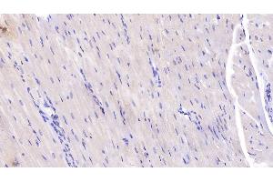Immunohistochemistry (IHC) image for anti-Interleukin 6 (IL6) (AA 27-241) antibody (ABIN7427780)