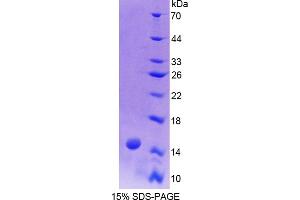 SDS-PAGE analysis of Human Biglycan Protein. (Biglycan Protein (BGN))