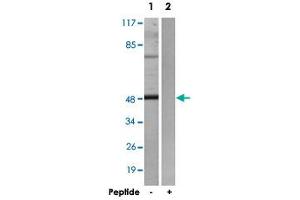 Western blot analysis of extracts from HepG2 cells, using ADRB2 polyclonal antibody .