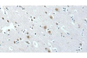 Immunohistochemistry of paraffin-embedded Human brain tissue using ACLY Polyclonal Antibody at dilution 1:40 (ACLY antibody)