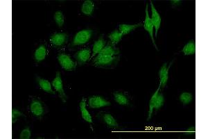 Immunofluorescence (IF) image for anti-SEC22b Vesicle Trafficking Protein (SEC22B) (AA 1-110) antibody (ABIN564121)