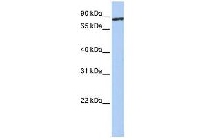 TMEM63A antibody used at 1 ug/ml to detect target protein.