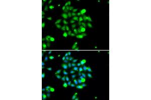 Immunofluorescence analysis of U2OS cells using UBE2G1 antibody (ABIN5974208). (UBE2G1 antibody)