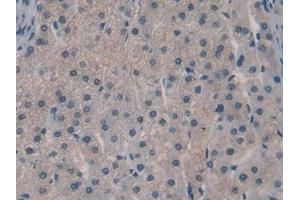 IHC-P analysis of Human Liver Tissue, with DAB staining. (SPRY3 antibody  (AA 91-288))