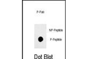 Dot blot analysis of anti-phospho-Sox2-p Phospho-specific Pab (ABIN650873 and ABIN2839817) on nitrocellulose membrane. (SOX2 antibody  (pSer249))