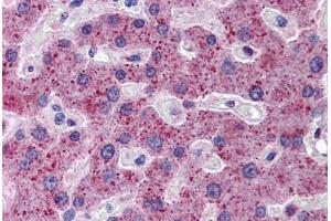 Human Liver: Formalin-Fixed, Paraffin-Embedded (FFPE) (TMPRSS6 antibody  (AA 71-120))