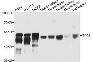 Western blot analysis of extracts of various cells, using TP53 antibody. (p53 antibody)