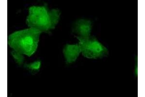 Image no. 7 for anti-V-Akt Murine Thymoma Viral Oncogene Homolog 2 (AKT2) antibody (ABIN1496564) (AKT2 antibody)