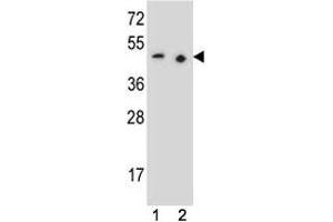 PAX9 antibody western blot analysis in (1) 293 and (2) Jurkat lysate (PAX9 antibody  (AA 69-95))