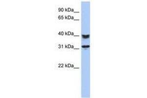 Image no. 1 for anti-Chromosome 5 Open Reading Frame 35 (C5orf35) (AA 71-120) antibody (ABIN6741237) (C5orf35 antibody  (AA 71-120))