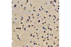 Immunohistochemical analysis of Lamin B2 staining in rat brain formalin fixed paraffin embedded tissue section.