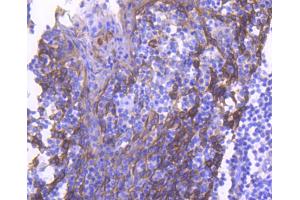Paraformaldehyde-fixed, paraffin embedded human tonsil, Antigen retrieval by boiling in sodium citrate buffer (pH6) for 15min, Block endogenous peroxidase by 3% hydrogen peroxide for 30 minutes, Blocking buffer at 37°C for 20min, Antibody incubation with Cytokeratin 4 (2F9) Monoclonal Antibody  at 1:50 overnight at 4°C, followed by a conjugated secondary and DAB staining. (KRT4 antibody)