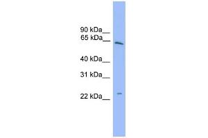 WB Suggested Anti-HSPB8 Antibody Titration: 0. (HSPB8 antibody  (Middle Region))
