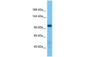 Host:  Rabbit  Target Name:  BOC  Sample Type:  Fetal Lung lysates  Antibody Dilution:  1. (BOC antibody  (Middle Region))