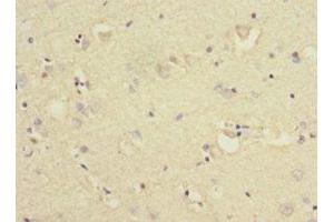 Immunohistochemistry of paraffin-embedded human brain tissue using ABIN7157566 at dilution of 1:100 (KLC1 antibody  (AA 274-573))