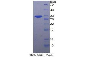 SDS-PAGE (SDS) image for Aldolase A, Fructose-Bisphosphate (ALDOA) (AA 18-273) protein (His tag) (ABIN1878969)